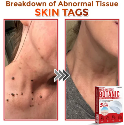 GRATIAO Removal Patch (2+1 Free)