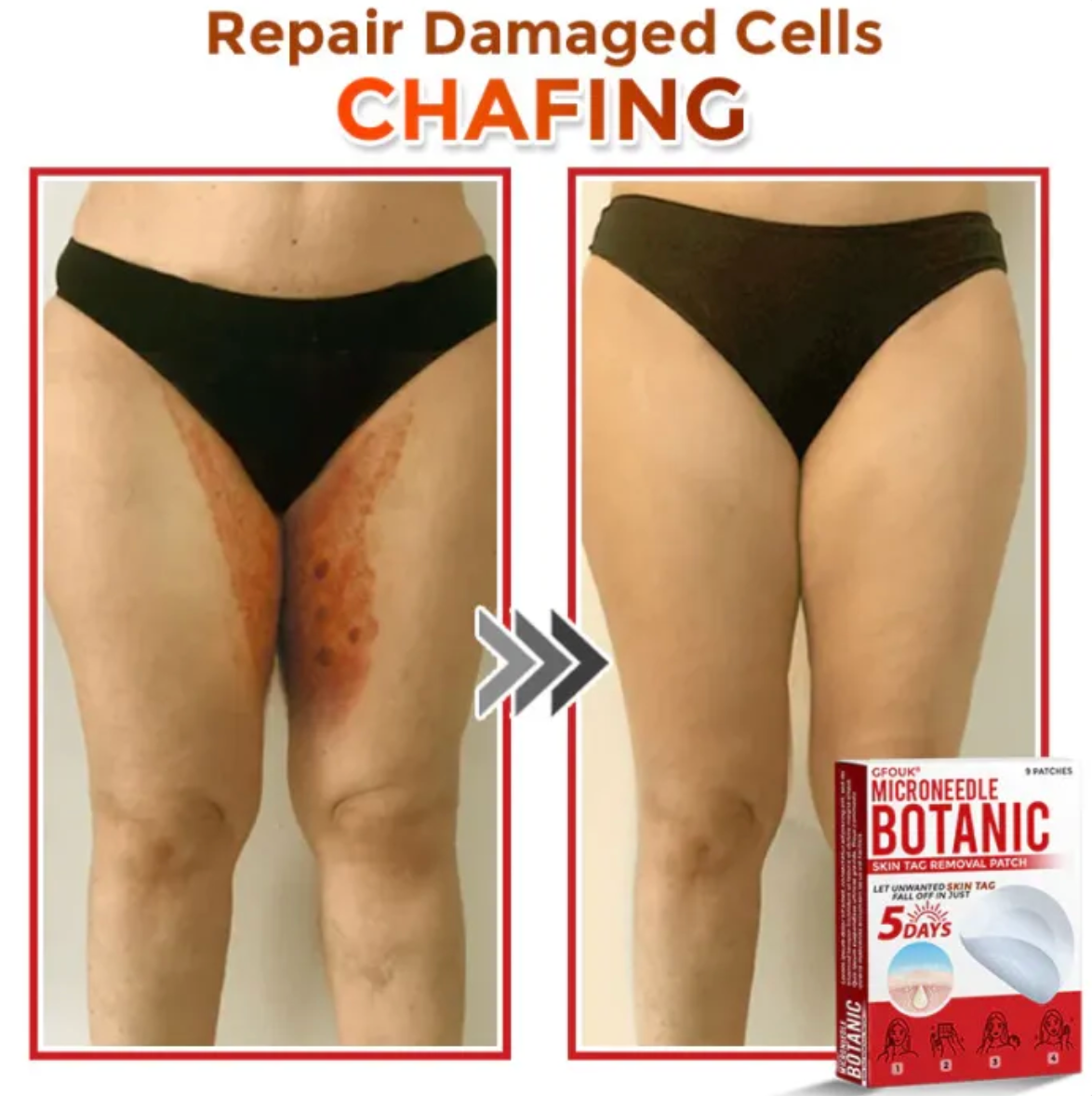 GRATIAO Removal Patch (2+1 Free)