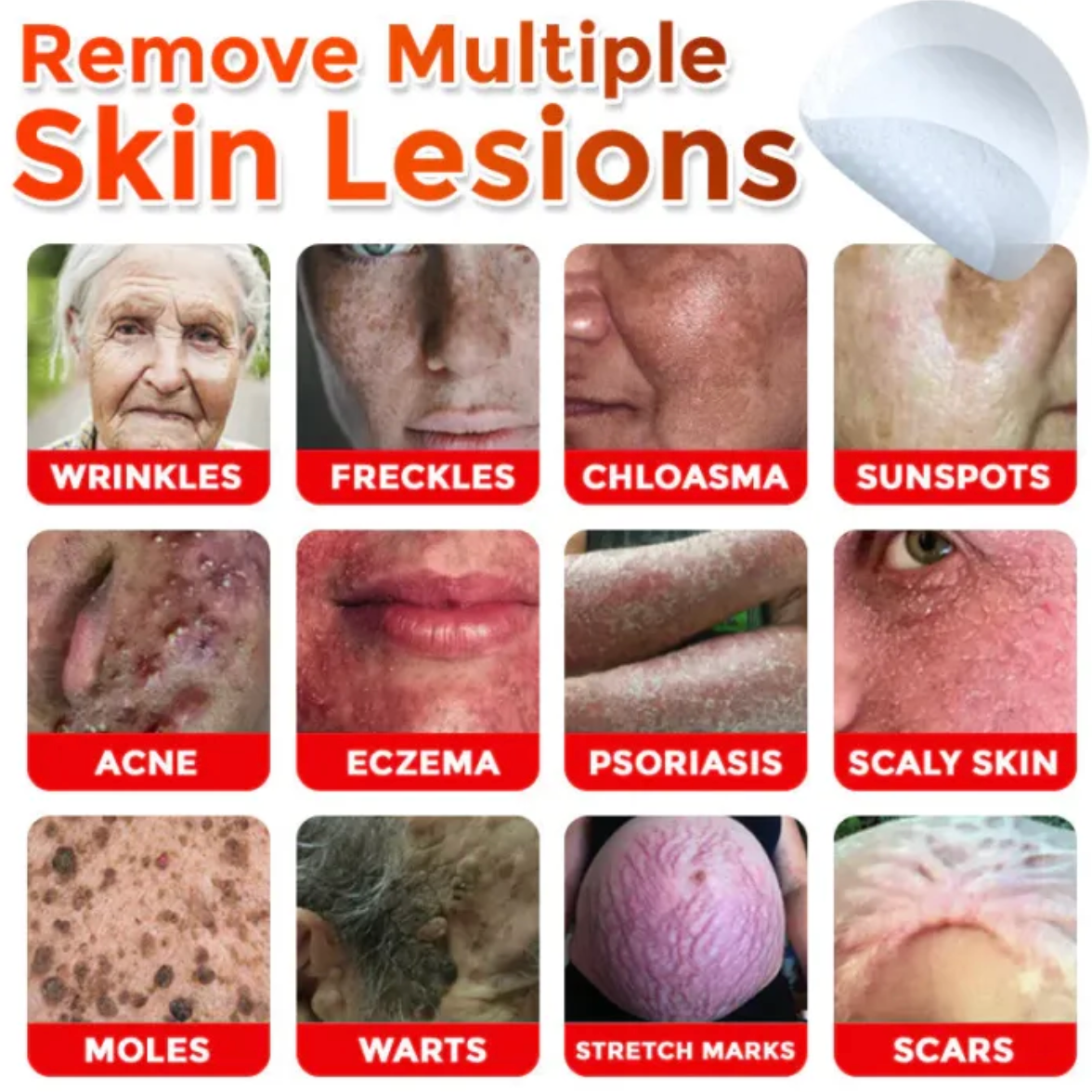 GRATIAO Removal Patch (2+1 Free)